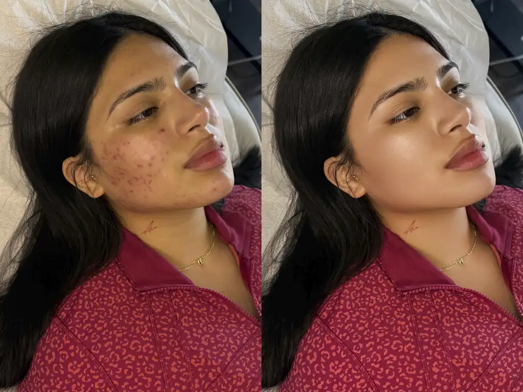 Close-up detail showing skin texture preserved during professional photo retouching